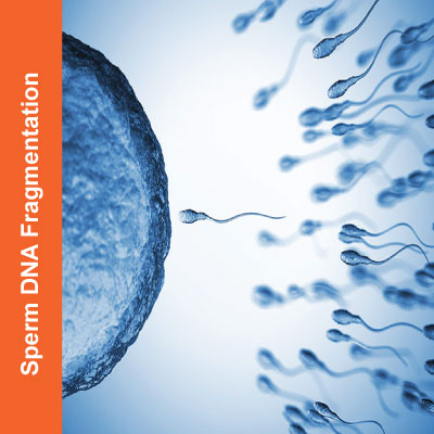 Sperm-DNA-Fragmentation