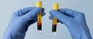 prp treatment for male infertility