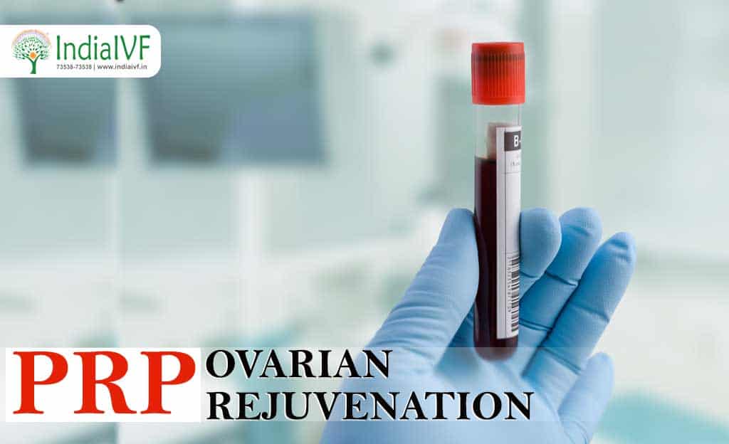 Ovarian PRP