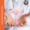 endometrial-scratching